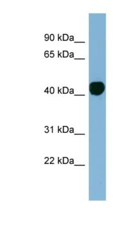 Histone H2AY/macroH2A.1 Antibody, Novus Biologicals:Antibodies:Primary