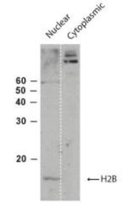 Histone H2B, member S Antibody, Novus Biologicals:Antibodies:Primary Antibodies