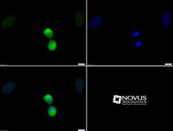Histone H3, p Thr11 Antibody - BSA Free, Novus Biologicals 0.025 mg | Buy Online | Novus Biologicals | Fisher Scientific