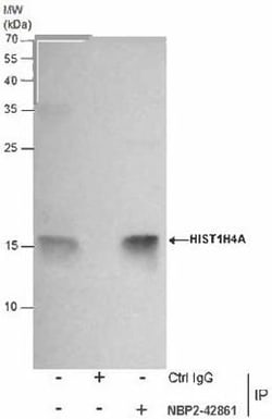 Histone H4, Dimethyl Lys20 Antibody (1851), Novus Biologicals 0.1mL; Unlabeled:Antibodies,