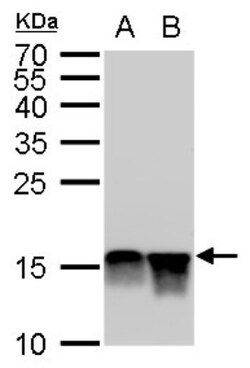 Histone H4, Dimethyl Lys20 Antibody (1851), Novus Biologicals 0.1mL; Unlabeled:Antibodies,