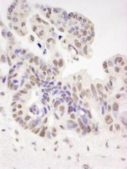 HIV-1 Tat specific factor 1 Antibody, Novus Biologicals 0.1mL; Unlabeled:Antibodies,