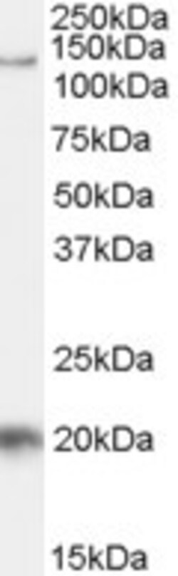 HIV-1 Tat specific factor 1 Antibody, Novus Biologicals 0.1mg; Unlabeled:Antibodies,