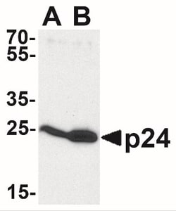 HIV-1 Gag p24 Antibody - BSA Free, Novus Biologicals:Antibodies:Primary