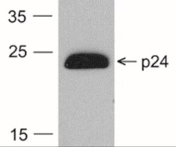 HIV-1 Gag p24 Antibody (7F4), HRP, Novus Biologicals 0.1mg; HRP:Antibodies,
