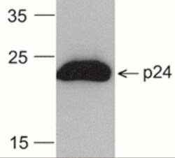 Mouse anti-HIV-1 p24, HRP, Clone: 8G9, Novus Biologicals 0.1mg; HRP:Antibodies,