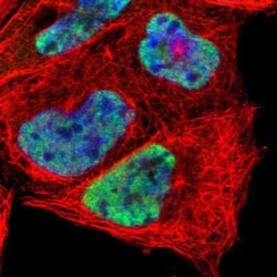 HIV-1 Tat specific factor 1 Antibody, Novus Biologicals 0.1mL; Unlabeled:Antibodies,