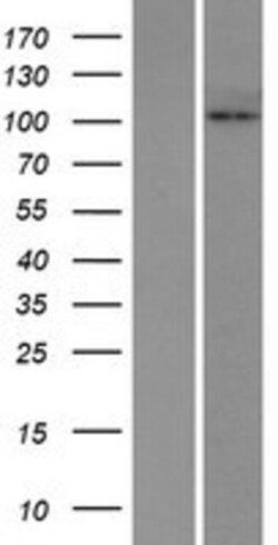 Novus Biologicals&trade;&nbsp;HKDC1 Overexpression Lysate