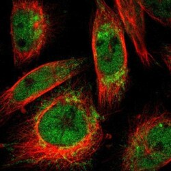 HKDC1 Antibody, Novus Biologicals:Antibodies:Primary Antibodies