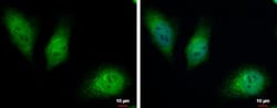HKDC1 Antibody, Novus Biologicals 0.1mL:Antibodies, Polyclonal