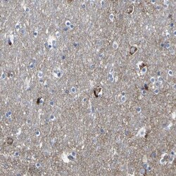HKDC1 Antibody, Novus Biologicals:Antibodies:Primary Antibodies