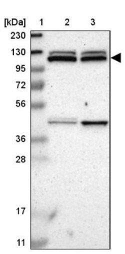 HKDC1 Antibody, Novus Biologicals:Antibodies:Primary Antibodies