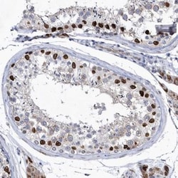 HKR1 Antibody, Novus Biologicals:Antibodies:Primary Antibodies