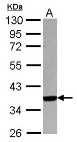 HLA A Antibody, Novus Biologicals 0.1mL; Unlabeled:Antibodies, Polyclonal