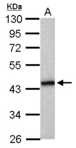 HLA B Antibody, Novus Biologicals 0.1mL; Unlabeled:Antibodies, Polyclonal