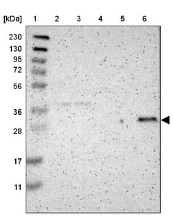 HLA DMB Antibody, Novus Biologicals 0.1mL; Unlabeled:Antibodies, Polyclonal