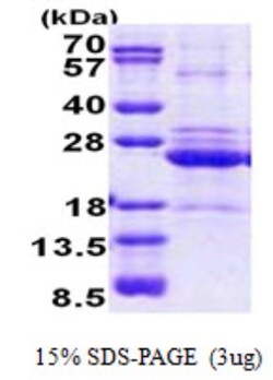Novus Biologicals&trade;&nbsp;Recombinant Human HLA DOA His Protein