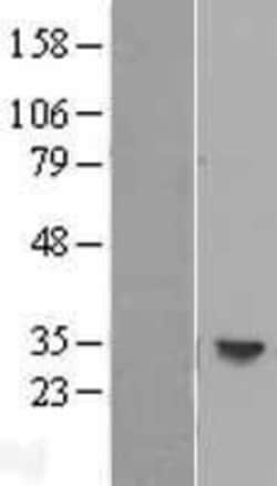 Novus Biologicals™ HLA DOB Overexpression Lysate