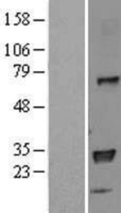 Novus Biologicals&trade;&nbsp;HLA DPB1 Overexpression Lysate