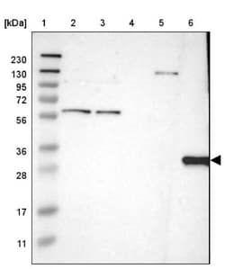 HLA DQB1 Antibody, Novus Biologicals 0.1mL; Unlabeled:Antibodies, Polyclonal