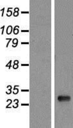 Novus Biologicals&trade;&nbsp;HLA DQB1 Overexpression Lysate