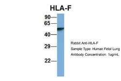 HLA F Antibody, Novus Biologicals 100&mu;L; Unlabeled:Antibodies, Polyclonal