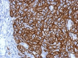 HLA G Antibody, Novus Biologicals 0.1mL; Unlabeled:Antibodies, Polyclonal