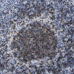 HLA DOB Antibody, Novus Biologicals 0.1mL; Unlabeled:Antibodies, Polyclonal
