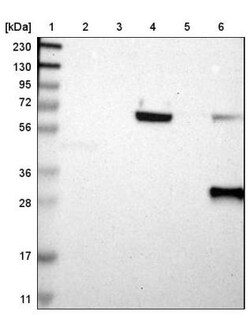 HLA DPB1 Antibody, Novus Biologicals 25 &mu;L; Unlabeled:Antibodies, Polyclonal