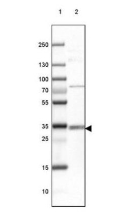 HLA DQA1 Antibody, Novus Biologicals 0.1mL; Unlabeled:Antibodies, Polyclonal