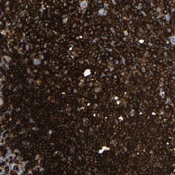 HLA DQB1 Antibody, Novus Biologicals 0.1mL; Unlabeled:Antibodies, Polyclonal