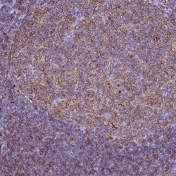 HLA DRB5 Antibody, Novus Biologicals:Antibodies:Primary Antibodies