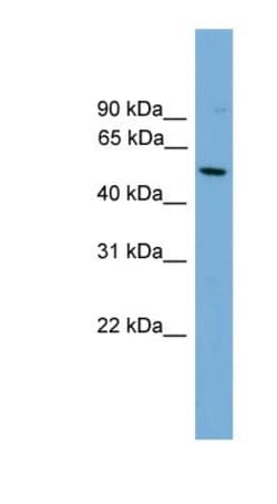 HLA F Antibody, Novus Biologicals 100&mu;L; Unlabeled:Antibodies, Polyclonal