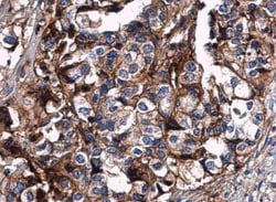 HLA G Antibody, Novus Biologicals 0.1mL; Unlabeled:Antibodies, Polyclonal