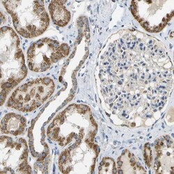 HLCS Antibody, Novus Biologicals 0.1mL; Unlabeled:Antibodies, Polyclonal