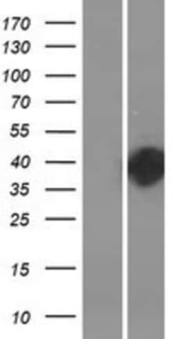 Novus Biologicals™ HLRC1 Overexpression Lysate