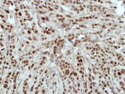 HLTF Antibody, Novus Biologicals 0.1mL; Unlabeled:Antibodies, Polyclonal