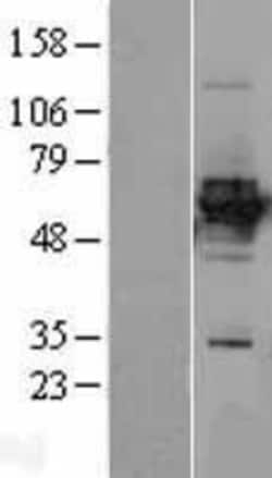 Novus Biologicals&trade;&nbsp;HLX1 Overexpression Lysate