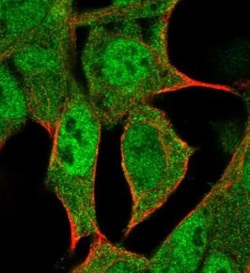 HLX1 Antibody, Novus Biologicals:Antibodies:Primary Antibodies