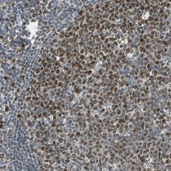 HLX1 Antibody, Novus Biologicals:Antibodies:Primary Antibodies