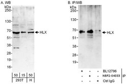 HLX1 Antibody, Novus Biologicals 0.1mg; Unlabeled:Antibodies, Polyclonal