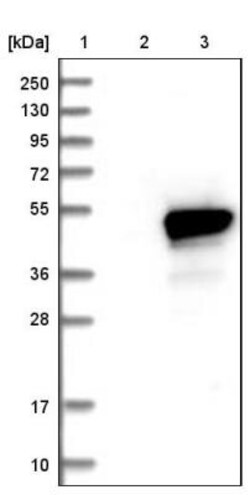 HMBS Antibody, Novus Biologicals 0.1mL; Unlabeled:Antibodies, Polyclonal