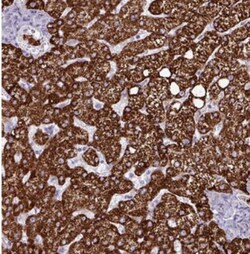 HMCN1 Antibody, Novus Biologicals 25 &mu;L, Unlabeled:Antibodies, Polyclonal