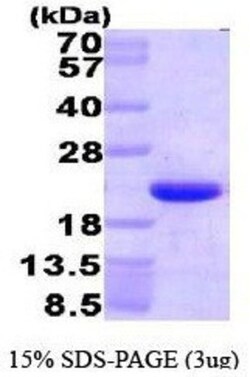 Novus Biologicals&trade;&nbsp;Recombinant Human HMGN1/HMG14 His Protein