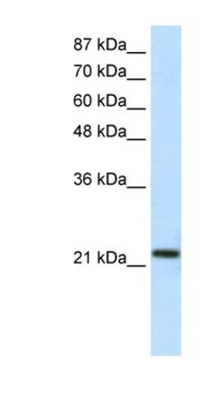 HMG1L10 Antibody, Novus Biologicals:Antibodies:Primary Antibodies