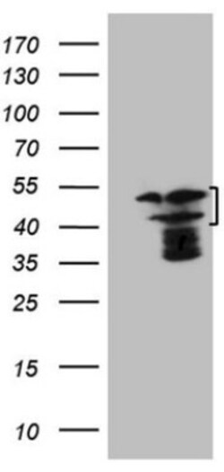 HMG20A Antibody (OTI2H4), Novus Biologicals 0.1 mL | Buy Online | Novus Biologicals | Fisher Scientific
