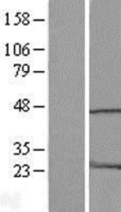 Novus Biologicals&trade;&nbsp;HMG20A Overexpression Lysate