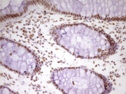 HMG20A Antibody (OTI2H4), Novus Biologicals 0.1 mL | Buy Online | Novus Biologicals | Fisher Scientific