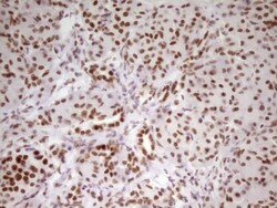 HMG20A Antibody (OTI2H4), Novus Biologicals 0.1 mL | Buy Online | Novus Biologicals | Fisher Scientific