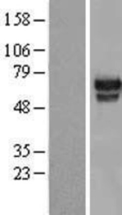 Novus Biologicals&trade;&nbsp;HMG2L1 Overexpression Lysate